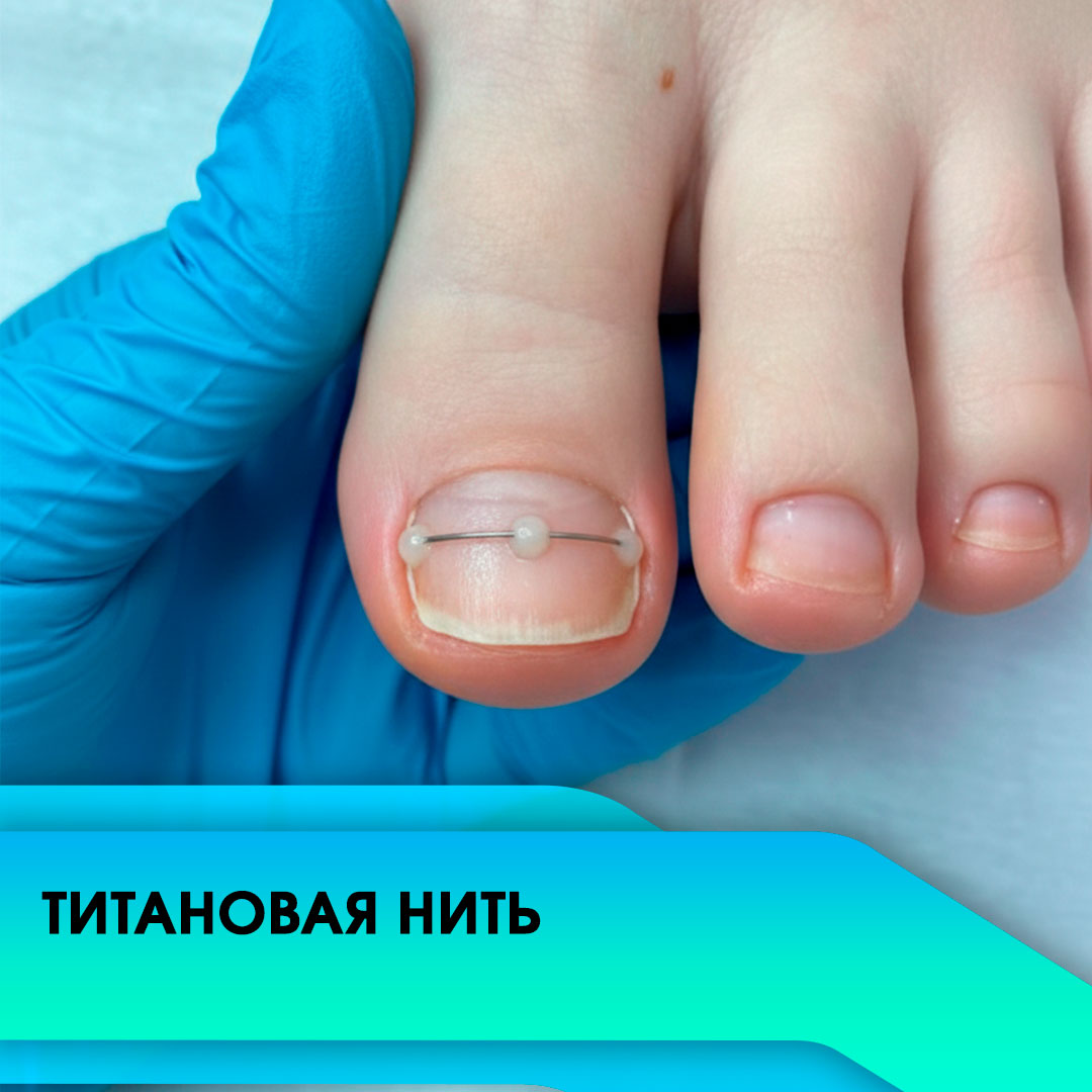 Онлайн-курс Титановая нить